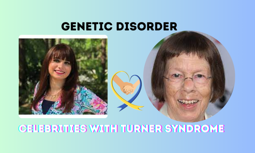 Celebrities with Turner Syndrome