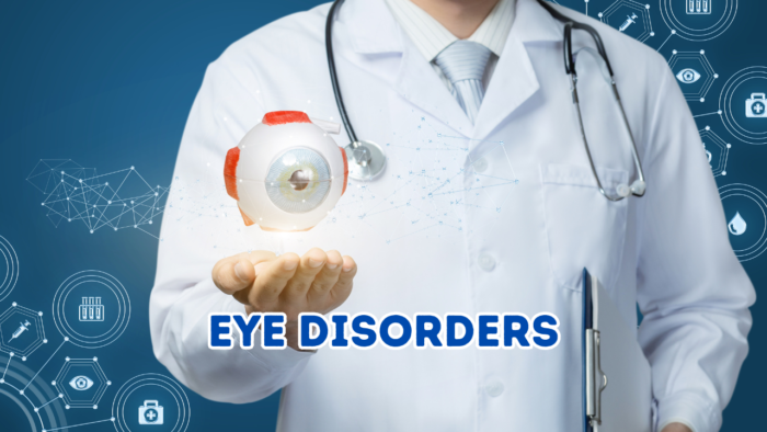 Eye Disorders