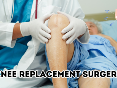 Knee Replacement Surgery