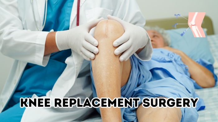 Knee Replacement Surgery
