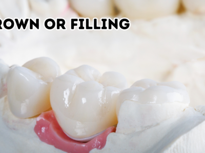 Crown or Filling