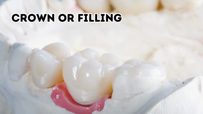 Crown or Filling