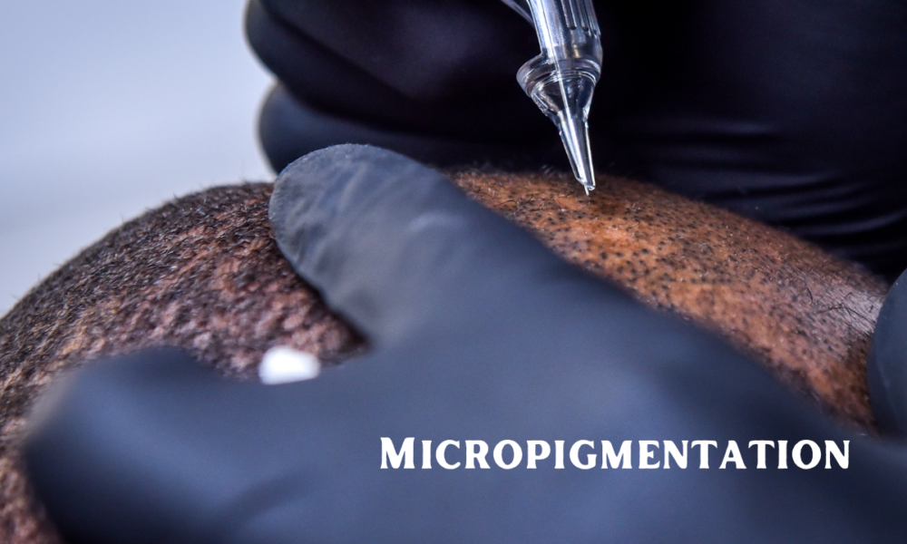 Micropigmentation