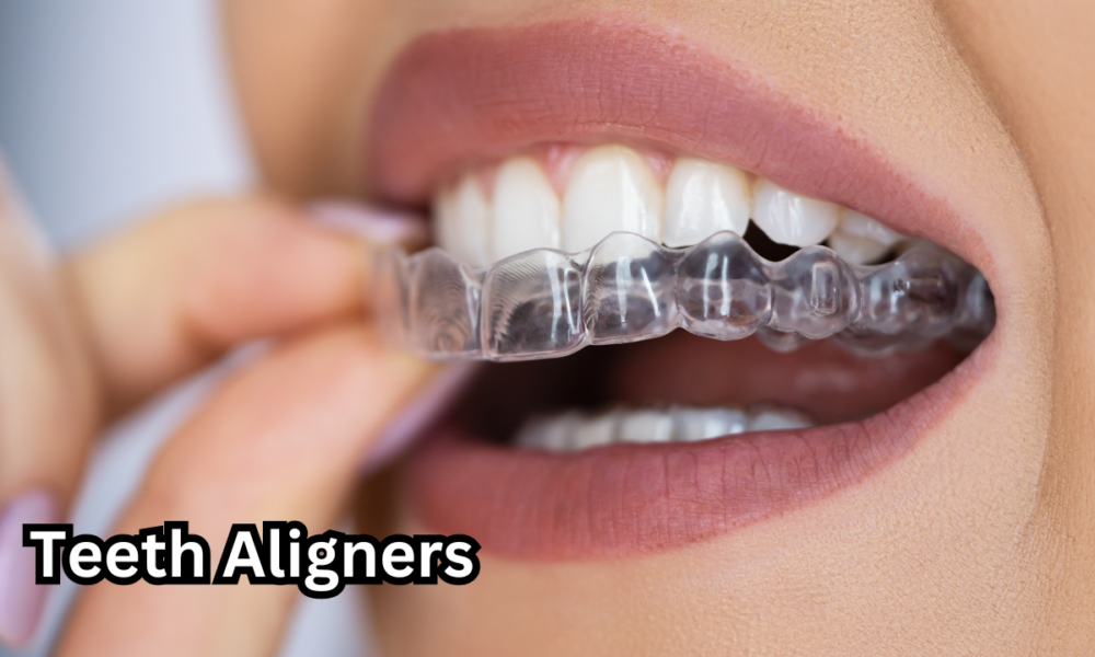 Teeth Aligners