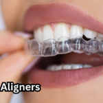 Teeth Aligners