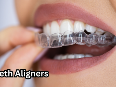 Teeth Aligners