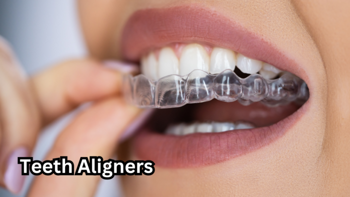 Teeth Aligners