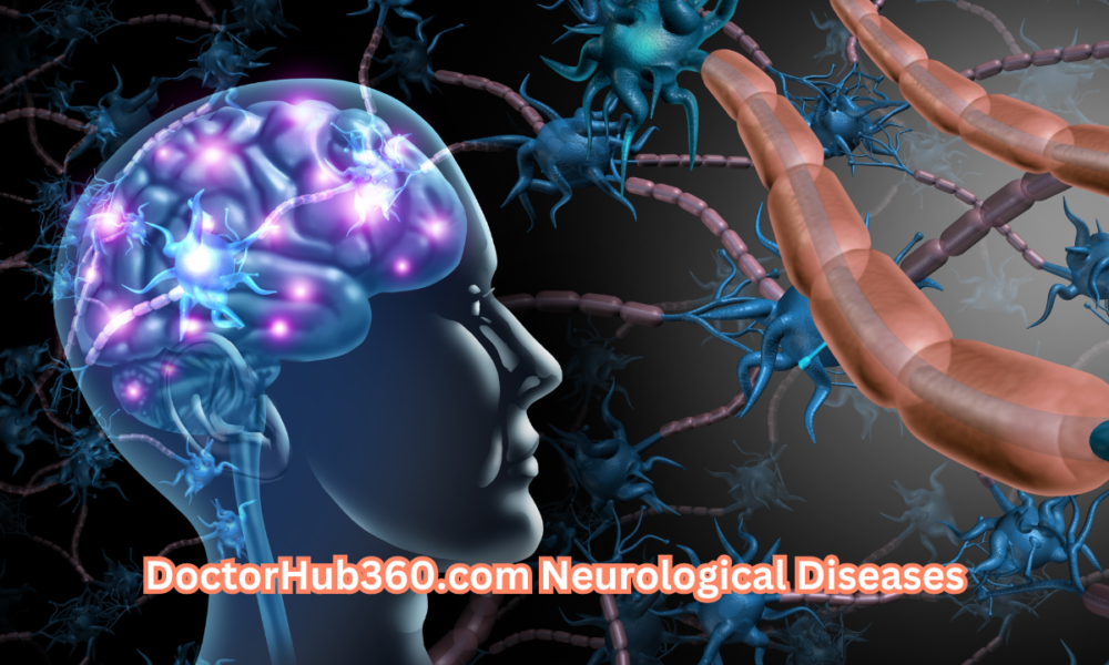 DoctorHub360.com Neurological Diseases