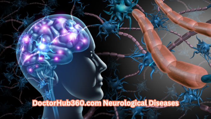 DoctorHub360.com Neurological Diseases