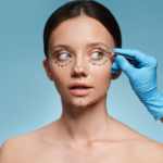 Blepharoplasty Surgery