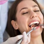 Hollywood Smile