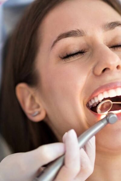 Hollywood Smile